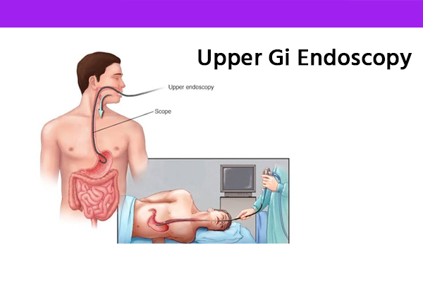 Upper Gastroinestinal Endoscopy