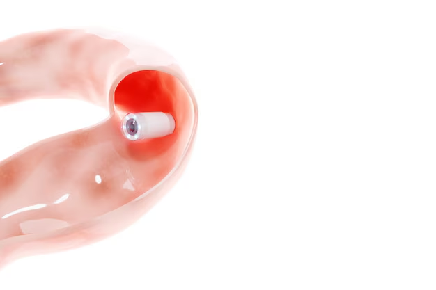 Video Capsule Endoscopy