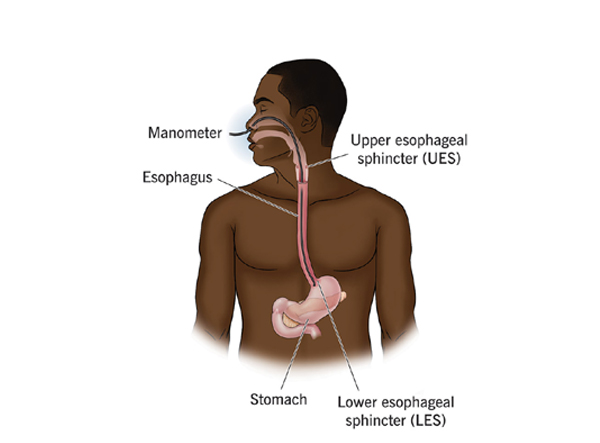 Esophageal Manometry
